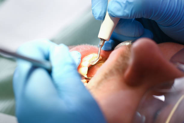 Best Emergency Gum Pain Relief  in Portola, CA