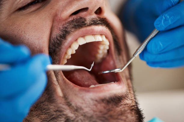 Best Tooth Pain Emergency Relief  in Portola, CA