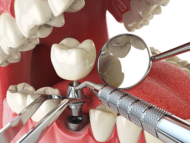 Best Emergency Tooth Extraction  in Portola, CA